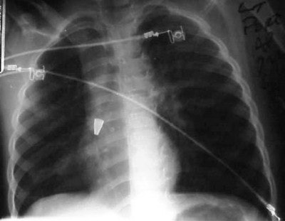 2004 04 23 16 29 38 706