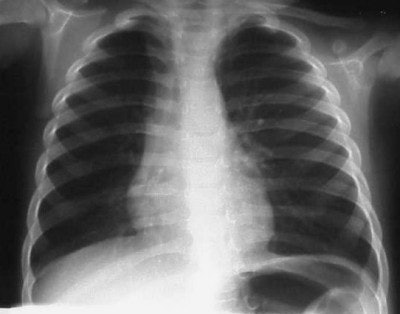 2004 04 23 16 29 54 706