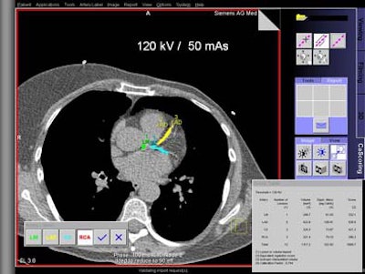 2004 04 26 09 49 24 706