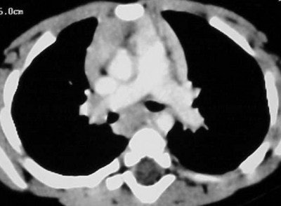 2004 05 06 15 37 03 706