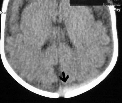 2004 05 11 17 08 23 706