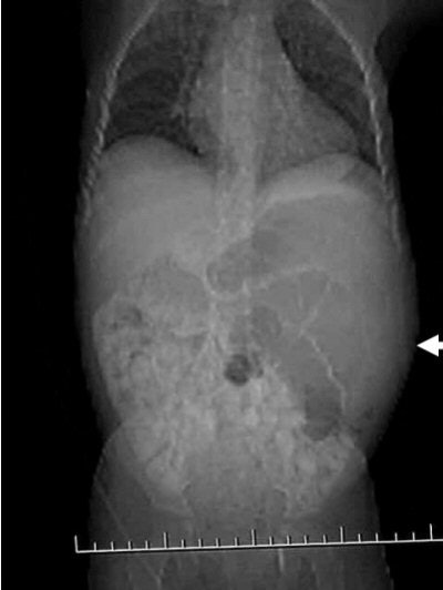 2004 05 11 17 10 02 706