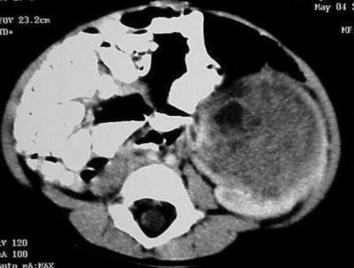 2004 05 11 17 10 18 706