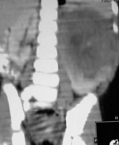 2004 05 11 17 10 35 706