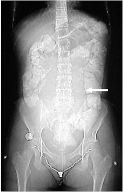 2004 05 11 17 11 42 706