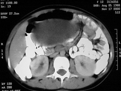 2004 05 11 17 11 59 706