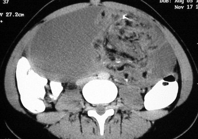 2004 05 11 17 12 19 706