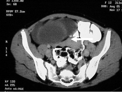 2004 05 11 17 12 37 706