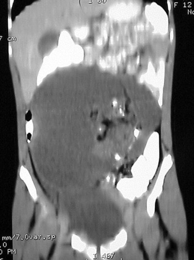 2004 05 11 17 12 56 706