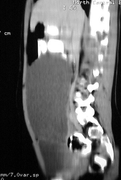 2004 05 11 17 13 34 706