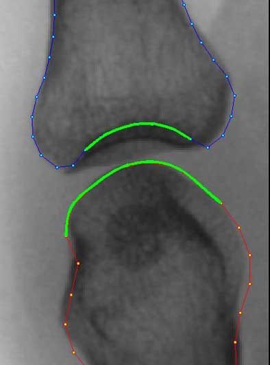 2004 05 17 14 24 45 706