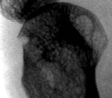 2004 05 17 14 25 09 706