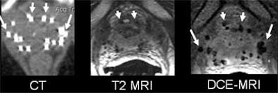 2004 05 18 16 42 53 706