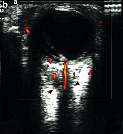 2004 05 24 14 54 21 706