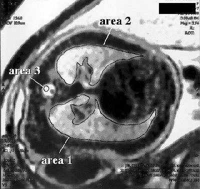 2004 05 26 14 51 37 706