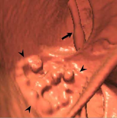 2004 05 28 14 59 12 706