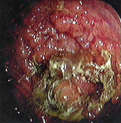 2004 05 28 14 59 31 706