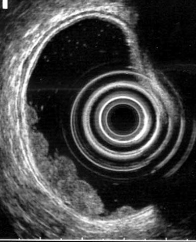 2004 05 28 14 59 55 706