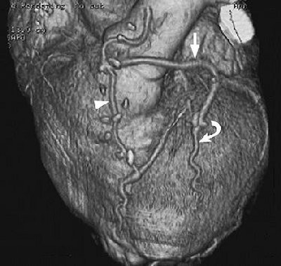 2004 06 02 11 10 34 706