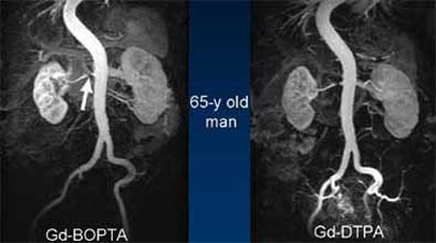 2004 06 27 20 22 14 706