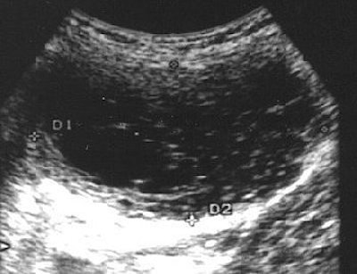 2004 06 25 14 58 20 706