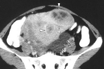 2004 06 25 15 00 42 706