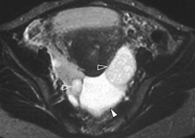 2004 06 25 15 02 07 706