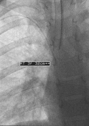 2004 07 07 11 44 40 706