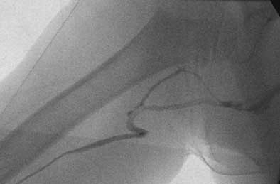 2004 07 07 11 45 04 706