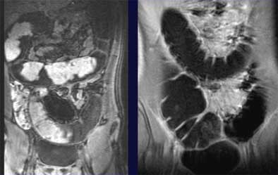 2004 07 09 16 31 00 706