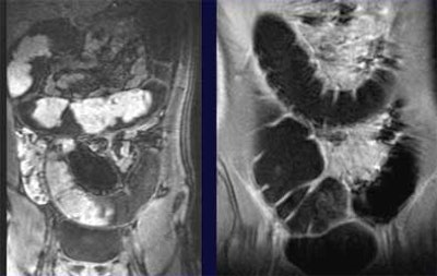 2004 07 09 16 31 00 706