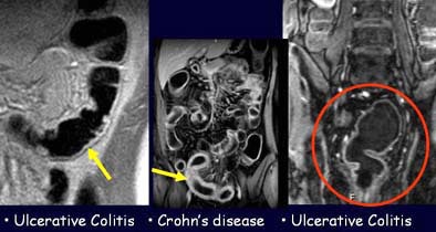 2004 07 09 16 33 12 706