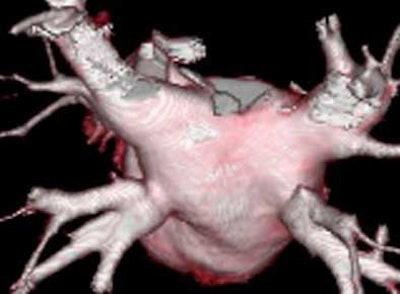 2004 07 16 13 24 11 706