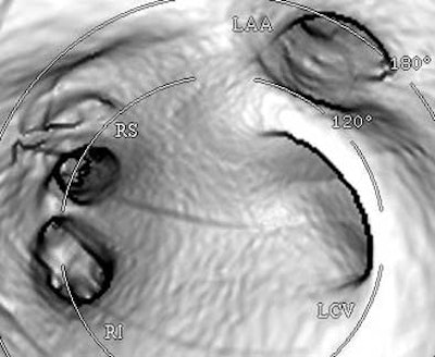 2004 07 16 13 47 24 706