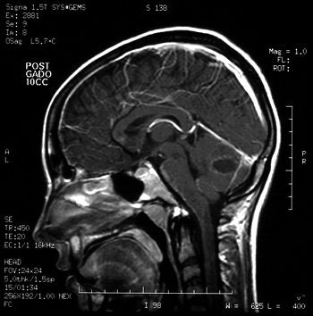 2004 07 16 14 12 00 706