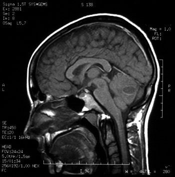 2004 07 16 14 15 34 706