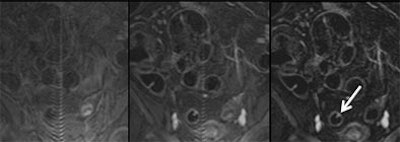 2004 07 20 15 51 28 706