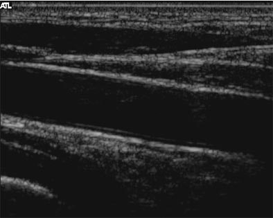 2004 07 22 14 53 31 706