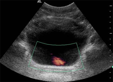 2004 07 22 16 35 44 706