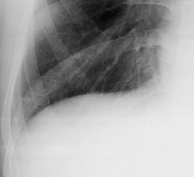 2004 08 11 14 16 54 706