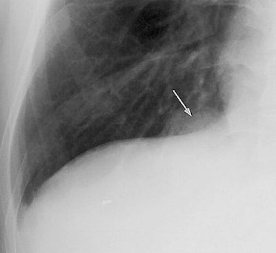 2004 08 11 14 17 43 706