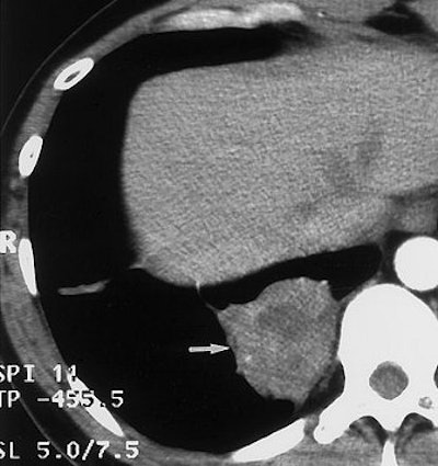 2004 08 11 14 18 23 706