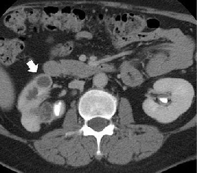 2004 08 11 14 19 03 706