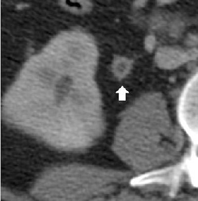 2004 08 11 14 19 37 706