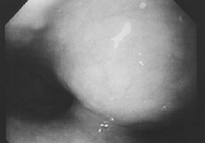 2004 08 11 14 20 11 706