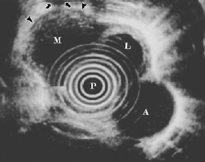 2004 08 11 14 20 47 706