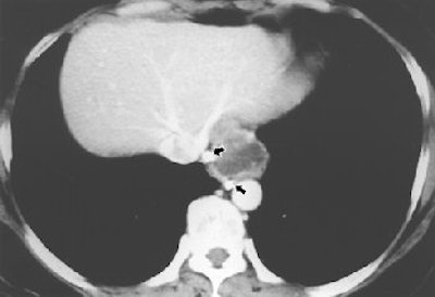 2004 08 11 14 21 33 706