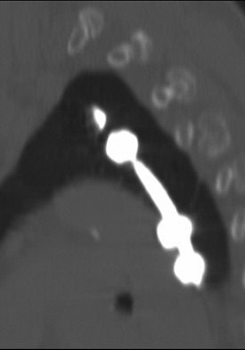 2004 08 16 10 55 17 706