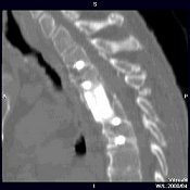 2004 08 16 11 03 53 706