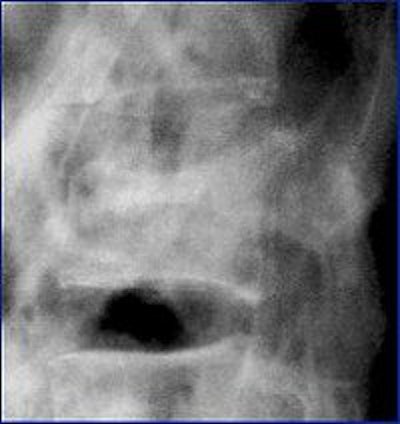 2004 08 17 10 44 11 706